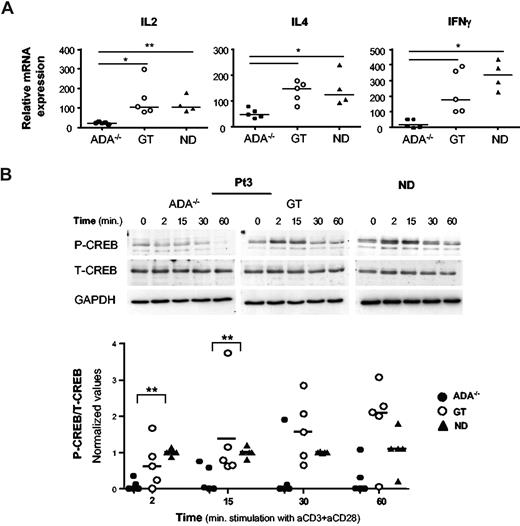 Figure 2. A defective transcription of cytokine genes in ADA-deficient T cells associates with reduced phosphorylation of CREB. (A) Cytokine gene expression after TCR/CD28-mediated stimulation of CD4+ T-cell lines from 5 patients (ADA−/− and GT) and 4 NDs. Total RNA was prepared from either resting or stimulated cells (1 μg/mL anti-CD3 plus 10 μg/mL anti-CD28 mAbs) and gene expression were measured by semiquantitative RT-PCR. Values were normalized for the expression of HPRT and correspond to duplicate samples. Results are expressed as n-fold difference relative to resting condition. One representative experiment of 3 is shown. **P < .01; *P < .05. (B) Immunoblots depicting phosphorylated CREB, total CREB, and GAPDH. CD4+ T cells were stimulated with cross-linked (1 μg/mL), anti-CD3 plus (10 μg/mL), anti-CD28 mAbs for the indicated time points. The same membranes were sequentially probed for the different Abs. Upper panel: a representative experiment in Pt3 (ADA−/− and GT) and one ND is shown. Lower panel: densitometric analysis and statistical significance (**P < .01) on 5 patients (ADA−/− and GT) and 5 NDs are shown. Values corresponding to unstimulated cells were subtracted.