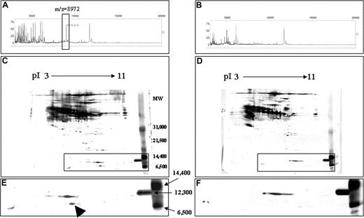 Figure 4. Purification of 8972-Da protein from murine plasma. Results from GVHD (A,C,E) and control (B,D,F) plasma are shown. (A,B) SELDI-TOF analyses of HPLC fraction 31.0 to 31.5 minutes derived from GVHD (A) and control (B) samples are shown. The box identifies a peak of 8972 Da that is overexpressed in GVHD (A), but not detectable in control plasma (B). (C,D) 2DE gel images of GVHD (C) and control (D) samples are shown. Plasma proteins (70 μg) of HPLC-purified fractions (pool of 31.0- to 31.5-minute fraction) from GVHD and control samples, respectively, were separated on pH 3-11 IPG in the first dimension, followed by SDS-PAGE on 8% to 20% gradient gel in the second dimension. The separated proteins were stained with silver nitrate. Insert is magnified in panels E,F. (E,F) Detailed views with apparent molecular mass of between 6500 and 14 400 Da in the 2DE gel images of GVHD (C) and control (D) samples are shown. Arrowhead indicates the candidate spot for the 8972-Da peak in GVHD (E) sample, which is not apparent in the control (F) sample.
