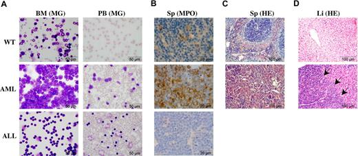 Figure 2. Phenotypic characterization of SRS19-6–injected mice. (A) Morphology of bone marrow cells and peripheral blood cells derived from a nonleukemic control mouse, a mouse with AML, and a mouse with T-ALL. Cells were stained with May-Grünwald-Giemsa. (B) Splenic sections were stained for myeloperoxidase (MPO) demonstrating the accumulation of immature myeloid cells in AML mice. (C) Disruption of the splenic architechture in the AML mouse. Sections were stained with hematoxylin-eosin (HE). (D) Massive infiltration of leukemic cells in the liver of an AML mouse. Sections were stained as in panel C. Arrows mark the boundary between infiltrating myeloid cells (left) and the normal liver tissue (right). Microscopy was performed using an Olympus BX40 microscope (Olympus, Cophenhagen, Denmark) mounted with an Olympus DP10 digital camera using the following lenses: 10× Plan0.25, 40× UplanFL0.75, or 100× Plan1.25 oil. Images were processed in Adobe Photoshop CS3 v.10.0.1 and Adobe Illustrator CS3 v13.0.2 (Adobe Systems, San Diego, CA).