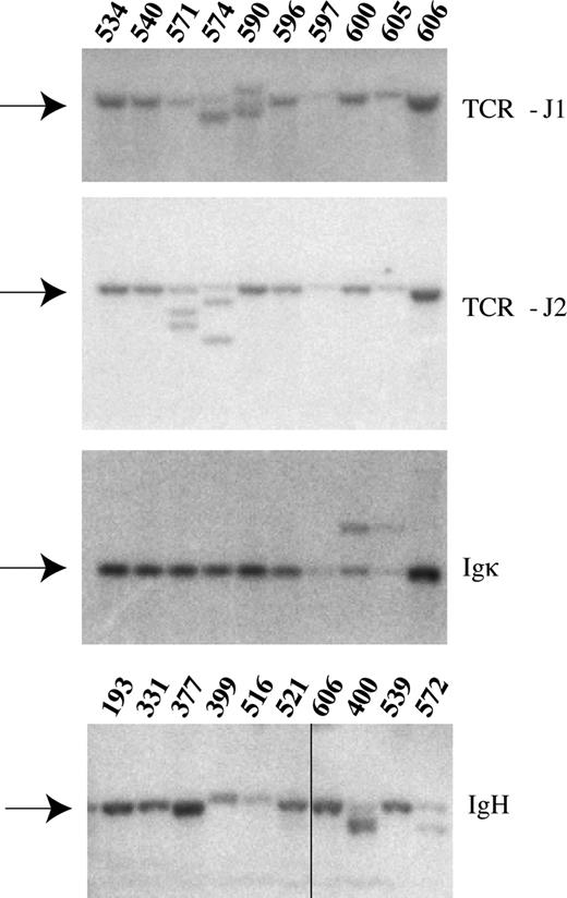 Figure 4. Rearrangements of the TCR-β and immunoglobulin genes. Representative Southern blot analysis of 10 enzyme-restricted splenic tumor DNA samples. Radioactive probes specific for TCR-J1, TCR-J2, IgH and Igκ were used to demonstrate variable degrees of rearrangements in these genes. The germ-line bands are indicated by arrows. Mouse ID numbers are indicated above the blots. Details on the individual animals can be found in Table S1. Vertical line has been inserted to indicate a repositioned gel lane.