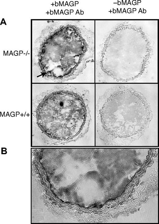 Figure 2. Immunohistochemistry showing localization of infused, recombinant bovine MAGP1 at the site of vascular injury. (A) Photomicrographs on the left are cross sections of carotid arteries from MAGP1+/+ and MAGP1−/− mice infused with 50 μg/kg recombinant bovine MAGP1 5 minutes prior to laser-induced injury. Vessels were harvested after complete cessation of blood flow and frozen sections immunostained using a bovine MAGP1-specific antibody. Staining is evident in the thrombus of both genotypes but is particularly prominent in the internal elastic lamina in the MAGP1−/− mouse (↗, and at higher power in panel B). Panels on the right show staining with antibovine MAGP1 of injured vessels from animals not injected with bovine MAGP1.