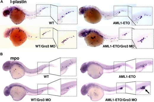 Figure 5. Accumulated immature ICM cells in AML1-ETO transgenic zebrafish embryos with Gro3/TLE knockdown are myeloid cells of the granulocytic lineage. Wild-type and AML1-ETO transgenic fish embryos were injected with Gro3 morpholino (MO) and subjected to mild heat shock treatment to induce low levels of AML1-ETO expression. The embryos were fixed at 32 hpf and were subjected to in situ hybridization for (A) the macrophage marker, l-plastin or for (B) myeloperoxidase (mpo), a marker for cells of the granulocytic lineage. The data indicate that knockdown of groucho in the presence of AML1-ETO expression leads to accumulation of mpo+ cells in the ventral tail region (arrow).