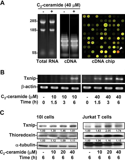 Figure 2. Ceramide induces Txnip mRNA and protein expression. (A) 10I cells were treated with 40 μM C2-ceramide for 2 hours. Cells were collected and total RNA was purified followed by cDNA synthesis. Total RNA (left) and cDNA (middle) were confirmed by agarose gel electrophoresis. After microarray analysis, the results of hybridization in the cDNA chip (right) revealed the up-regulated (red; arrowhead) and down-regulated (green) genes. (B) The effects of C2-ceramide on the mRNA expression of Txnip via a time- and dose-dependent manner were determined by RT-PCR. The expression of β-actin was used as an internal control. (C) The protein expression of Txnip and thioredoxin after various doses of C2-ceramide treatment was detected in 10I and Jurkat T cells using Western blot analysis. The α-tubulin expression was used as an internal control. The relative ratios of Txnip–α-tubulin and thioredoxin–α-tubulin are shown.