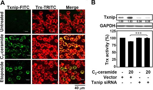Figure 3. Ceramide-up-regulated Txnip interacts with thioredoxin and reduces its activity. (A) Jurkat T cells were treated with 20 μM C2-ceramide or 25 μM etoposide for 6 hours, and the interaction of Txnip with thioredoxin was determined by confocal microscopic observation. After fixation with 1% formaldehyde in PBS, cells were incubated with Txnip and thioredoxin antibodies, followed by FITC-labeled (Txnip-FITC; green) and TRITC-labeled (Trx-TRITC; red) secondary antibodies, respectively. The colocalization of Txnip and thioredoxin was visualized (Merge; yellow). (B) In vector control– and hTxnip siRNA-transfected Jurkat T cells, Txnip protein expression was detected using Western blot analysis. The GAPDH expression was used as an internal control. The relative ratio of Txnip-GAPDH is shown. The thioredoxin activity was detected using an insulin reduction assay after 20 μM C2-ceramide treatment for 12 hours. Results are shown as means plus or minus SD of triplicate cultures. The vector control group without ceramide treatment was normalized as 100%. (***P < .001).