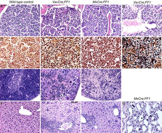 Figure 3. Histopathological analysis of VavCre;FF1 and MxCre;FF1 mice (20 weeks). H&E staining of bone marrow of both double transgenic mice (A) show trilineage hyperplasia with markedly increased numbers of megakaryocytes, most of which are morphologically abnormal (hyperchromatic, hyperlobulated nuclei, bizarre nuclear configuration) and present in clusters. (B) Dilated sinusoids were observed in 3/3 VavCre;FF1 mice in the bone marrow, but were absent in the 3 examined MxCre;FF1 mice. (C) Reticulin staining (Gömöri) demonstrates fibrosis in bone marrow. (D) Fibrosis also was seen in the spleen (only VavCre;FF1 is shown). (E) H&E staining of spleens demonstrate destruction of normal splenic architecture by atypical hematopoiesis in both MxCre;FF1 and VavCre;FF1 mice. In particular, megakaryocytes are markedly increased in numbers and display the same atypical morphology as in the bone marrow. (F) The liver shows extramedullary hematopoiesis indicated by the presence of megakaryocytes and clusters of granulopoiesis or erythropoiesis. (G) Megakaryocytes (arrowhead) were detected in the lung of MxCre;FF1 mice. VavCre;FF1 mice were not analyzed.