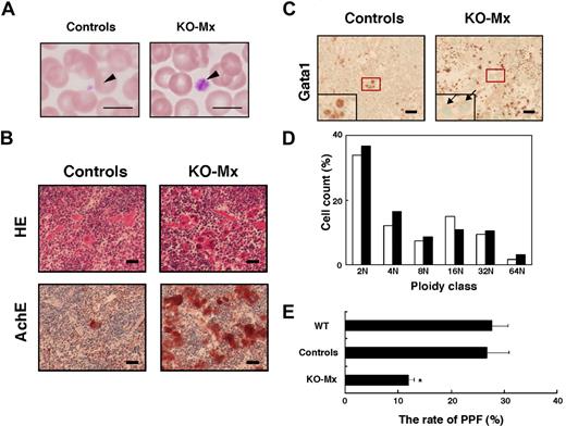 Figure 2. Mx-Cre–mediated deletion of the Gata1 gene in adult mice affects megakaryopoiesis. (A) Wright-Giemsa staining of peripheral blood smears prepared from the Gata1fl/y::Mx-Cre+ (KO-Mx) and the control mice. The arrowheads indicate platelets. Scale bar represents 10 μm. (B) Histologic examination of spleen sections prepared from the KO-Mx and the control mice. HE indicates hematoxylin and eosin staining; AchE, acetylcholinesterase staining. Original magnification ×100. Scale bar represents 40 μm. (C) Immunohistochemical analysis of spleen using anti-Gata1 antibody (N6). The insets represent higher magnifications of the red square areas. The arrows in the right panel indicate multinuclear megakaryocytes negative for Gata1 immunostaining. Original magnification ×100. Scale bar represents 40 μm. (D) Megakaryocyte ploidy classes in the KO-Mx (■) and control (□) BM cells. (E) Rate (%) of proplatelet formation in cultured megakaryocytes in BM prepared from KO-Mx and control mice. Results are shown as mean plus or minus SD (error bars) from 3 mice (*P < .05 for KO-Mx compared with controls).