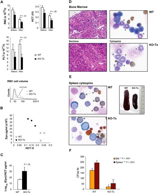 Figure 5. Gata1 is essential for the stress erythropoietic response. (A) Peripheral blood counts of the Tx-treated Gata1fl/y::Tx-Cre (KO-Tx) (■) and WT mice (□) after induction of hemolytic anemia with PHZ. Results are shown as mean plus or minus SD (error bars); n ≥ 3. RBC indicates red blood cell counts; HCT, hematocrit; PLT, platelet counts. Bottom graph displays the RBC volume of representative WT and KO-Tx samples. (B) Plasma Epo levels of KO-Tx (●) and WT (○) mice after induction of hemolytic anemia with PHZ. Epo values are plotted against HCT values for each mouse. (C) Log10 (Epo)/HCT ratios after PHZ treatment. Average and SD are shown; n ≥ 4. (D) BM sections (hematoxylin and eosin staining) and cytospins (Wright-Giemsa staining) of KO-Tx and WT mice after induction of hemolytic anemia with PHZ. (E) Spleens and Wright-Giemsa staining of cytospins from splenic cells of KO-Tx and WT mice after PHZ treatment. (F) CFUe assays of BM and spleen cells of KO-Tx and WT mice after induction of hemolytic anemia with PHZ.