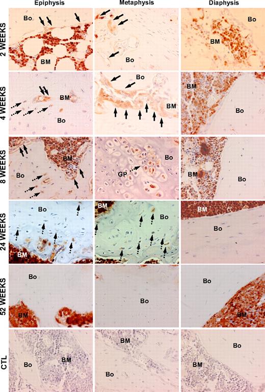 Figure 2. Patterns of bone engraftment with increasing time after transplantation of nonadherent bone marrow cells. Sections taken at 2 to 52 weeks after transplantation from different regions of bone (Bo) and bone marrow (BM) were stained with anti-GFP antibody (red). At 2 weeks, GFP+ osteoblasts (arrows) engrafted as clusters next to host (GFP−) osteoblasts in the epiphysis and in the metaphysis, while in the diaphysis the osteoblasts remained almost exclusively host derived. Beginning at 4 weeks, GFP+ osteocytes (dashed arrows) were consistently detected in both the metaphysis and epiphysis. At 8 weeks, in the metaphysis, in particular, Bo-embedded GFP+ cells could be identified under the growth plate (GP) as cell clusters. Again, the donor contribution was virtually undetectable in the diaphysis. At 24 weeks, a similar pattern of donor-derived osteopoiesis was evident. By 52 weeks, neither donor Bo nor BM contained GFP+ osteoblasts or osteocytes. The bottom row consists of photomicrographs of control (CTL) Bo/BM sections from a mouse that received a transplant of untransduced cells that were stained with anti-GFP antibody. Original magnification of all panels, 400×.