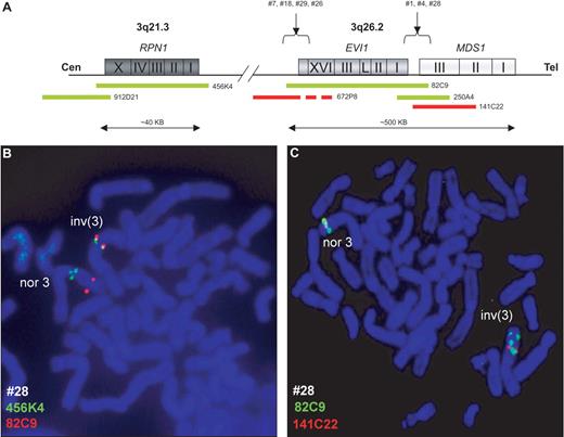 Figure 4. Fluorescent in situ hybridization (FISH) of chromosome 3q26 and 3q21 loci reveal hidden 3q26 aberrations. BAC clone localization from centromere (Cen) to telomere (Tel) (A). A metaphase from EVI1+ patient no. 28 revealed a cryptic inv(3)(q21q26) (inv3) and a normal chromosome 3 (nor3) using EVI1 (RP11-82C9) and MDS1 (RP11-141C22) (B) and RPN1 (RP11-456K4) BAC clones (C). Micrographs after FISH were acquired by imaging with a fluorescence microscope (Axio-Imager Z1; Zeiss, Sliedrecht, The Netherlands) fitted with a Plan-Apochromat at 100x/1.40 numeric aperture oil objective, a CCD video camera (Metasystems, Altlussheim, Germany), and using Isis software for capturing and processing fluorescent images (v5.1.7, Metasystems).