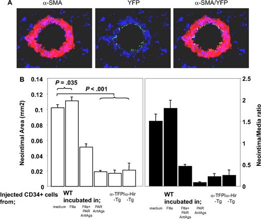 Figure 2. Manipulated CD34+ cells influence development of IH. (A) 3-color immunohistologic analysis of carotid artery sections from injured WT mice taken on day 5 after injury. On day of injury, mice received 7.5 × 105 CD34+ cells from ROSA-EYFP mice—these were exposed to thrombin 50 nM for 1 hour immediately before injection. Sections were stained with anti–α-SMA (red) and DAPI (blue). Original images taken at ×100 magnification. (B) Neointimal area (left panel) and intima-media ratios (right panel) of vessels taken from WT animals 28 days after injury. All received 7.5 × 105 CD34+ cells on the day of injury from WT or Tg mice. The cells from WT mice were incubated in vitro for 1 hour, as indicated, prior to injection. Data derived from examination of 3 random sections from 5 different vessels. Data are presented as means plus or minus SEM.