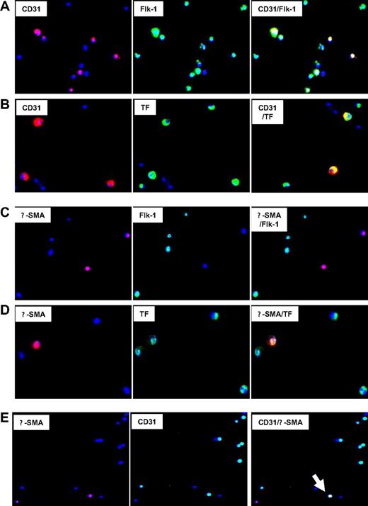 Figure 4. Immunocytochemical analysis of phenotype of CD34+ cells after injury. Immunocytochemical analysis of CD34+ cells isolated on day 2. All cells stained with DAPI (blue). Original images taken at 100× magnification—some of the images chosen have been electronically magnified (1-3×) in the process of selecting appropriate fields. (A) Cells stained for CD31 (red) and Flk-1 (green). Dual exposure image is on the right and illustrates that all CD31-expressing cells coexpress Flk-1 (yellow), but not all Flk-1+ cells express CD31 (green). (B) Cells stained for CD31 (red) and TF (green). Dual exposure image is on the right and shows that all CD31-expressing cells stain for TF (yellow). (C) Cells stained for α-SMA (red) and Flk-1 (green). Dual exposure image is on right of the panel, and illustrates that in this field, none of the α-SMA–expressing cells stain for Flk-1. (D) Cells stained for α-SMA (red) and TF (green). Dual exposure image is on right of the panel, and shows that the single α-SMA–expressing cell in this field stains for TF (yellow). (E) Cells stained for α-SMA (red) and CD31 (green). Dual exposure image is on right of the panel, and shows a single cell in this field that stains for both markers (yellow). Representative of 2 independent assessments.