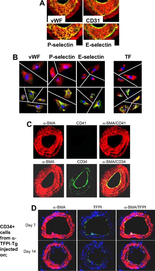 Figure 5. Phenotype of neointimal cells. (A) 2-color immunohistologic analysis of carotid artery sections from WT arteries taken on day 28 after injury. Consecutive sections were stained with anti–α-SMA (red) and either anti-VWF, anti-CD31, anti–P-selectin, or anti–E-selectin (green). Yellow indicates colocalization. Original images taken at ×100 magnification. (B) 3-color immunohistologic analysis of single cells isolated from intima of control uninjured (top row) and day 28–injured arteries (bottom row) from WT mice. Cells were prepared after first scraping off and discarding the luminal layer. All sections were stained with DAPI (blue), anti–α-SMA (red), and (green) either anti-VWF, anti–P-selectin, or anti–E-selectin. Yellow indicates colocalization. Original images taken at ×400 magnification and then enlarged 5× digitally. As indicated by the white lines, images of individual cells have been cut and spliced into a single frame in Adobe Photoshop (San Jose, CA). (C) 2-color immunohistologic analysis of carotid artery sections from WT arteries taken on day 28 after injury. Dual exposure image is on the right. Consecutive sections were stained with anti–α-SMA (red) and (green) either anti-CD41 (top row) or anti-CD34 (bottom row). Yellow indicates colocalization. Original images taken at ×100 magnification. (D) 3-color immunohistologic analysis of carotid artery sections from WT arteries taken on day 21 after injury. Injured mice were injected with 7.5 × 105 CD34+ cells from α-TFPI–Tg mice on day 7 (top row) or day 14 (bottom row). All sections were stained with DAPI (blue), anti–α-SMA (red) and anti-TFPI (green). (A-D) Representative of experiments performed on at least 2 independent cohorts of animals.