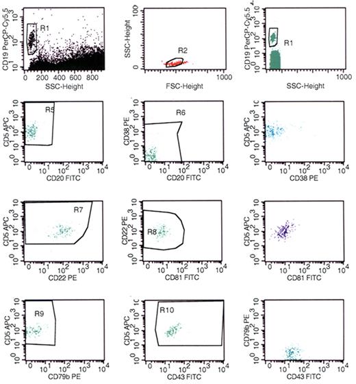 Figure 4. Flow cytometric detection of minimal residual CLL Detection using the protocol published by Rawstron and colleagues.10 Top row of plots demonstrate preliminary gating on CD19+ B cells with low orthogonal (side) light scatter and refinement of the gate using a plot of forward versus low orthogonal (side) light scatter. Bottom 3 rows of plots demonstrate representative dot-plots from 3 separate tubes evaluating CD5, CD20, and CD38, (second row); CD5, CD22, and CD81 (third row); and CD5, CD43, and CD79b (bottom row). Only the CD19+ gated events are displayed. Regions are placed around events with phenotypic features characteristic of CLL: R5 indicates dim CD20 and CD5+; R6, dim CD20 and dim to moderate intensity CD38 staining; R7, CD5+ and CD22+; R8, CD22+ and dim CD81; R9, CD5+; and CD79bdim, R10, CD5+ and CD43+. Residual CLL is identified by more than 50 events meeting the criteria for 2 or more of the following: R5 and R6 (displayed in second row right dot plot), R7 and R8 (displayed in third row right dot plot), R9 and R10 (displayed in bottom row right dot plot). The flow cytometric data were acquired using a BD FACS Calibur flow cytometer (BD Biosciences) and the dot plots were created using BD CellQuest software v3.3 (BD Biosciences).