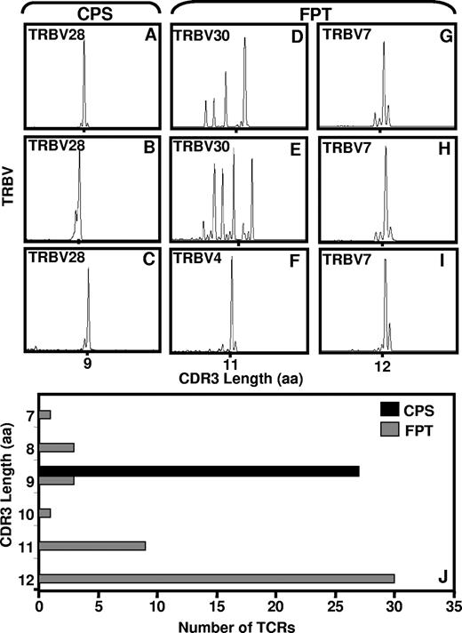 Figure 3. Immunoscope analysis of the CDR3 region of TCR specific for CPS- and FPT-specific T cells. cDNA samples from PBMCs or in vitro–expanded T cells cultures were used for PCR reaction with Vβ specific primers as outlined in “Methods,” and results were analyzed using ABI PRISM GeneScan software. Panel A shows the representative immunoscope profile of CPS-specific CD8+ T cells sorted from fresh PBMCs using pMHC-peptide pentamer; panels B and C show data based on in vitro–expanded T-cell lines. Data in panel A was obtained from donor 2, while data in panels B and C was acquired from donors 1 and 2, respectively. Panel D shows representative data for FPT-specific T cells sorted from fresh PBMCs using pMHC-peptide pentamer; panels E-I show data based on in vitro–cultured T-cell lines. Data presented in panels D and E are from donor 1; data in panels F-H were from donor 2; while data in panel I was from donor 6, respectively. Panel J shows a comprehensive summary of multiple CDR3 profiles for CPS- and FPT-specific T cells. Data presented in panel J is based on the analysis carried out in 3 different HLA B*3508 + individuals.