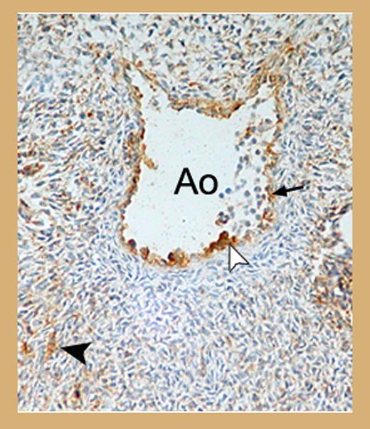 Expression of BB9 in the AGM region of the developing human embryo. See the complete figure in the article beginning on page 4055.