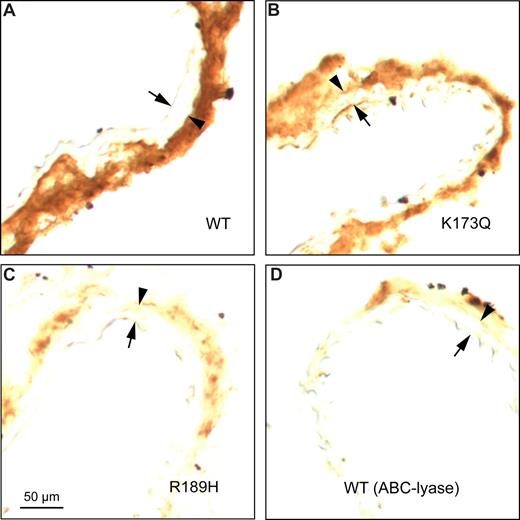 Figure 5. Binding of HCII to carotid arterial sections in vitro. Frozen sections were incubated for 1 hour at room temperature with 20 μg/mL rHCIIWT (A), rHCIIK173Q (B), or rHCIIR189H (C) in PBS. After 2 rinses with buffer, the sections were stained with a polyclonal goat anti-HCII IgG. The section in panel D was treated with chondroitin ABC-lyase to degrade DS prior to incubation with rHCIIWT. Arrow indicates internal elastic lamina; arrowhead, external elastic lamina. rHCIIWT and rHCIIK173Q bound strongly to sites in the adventitia.