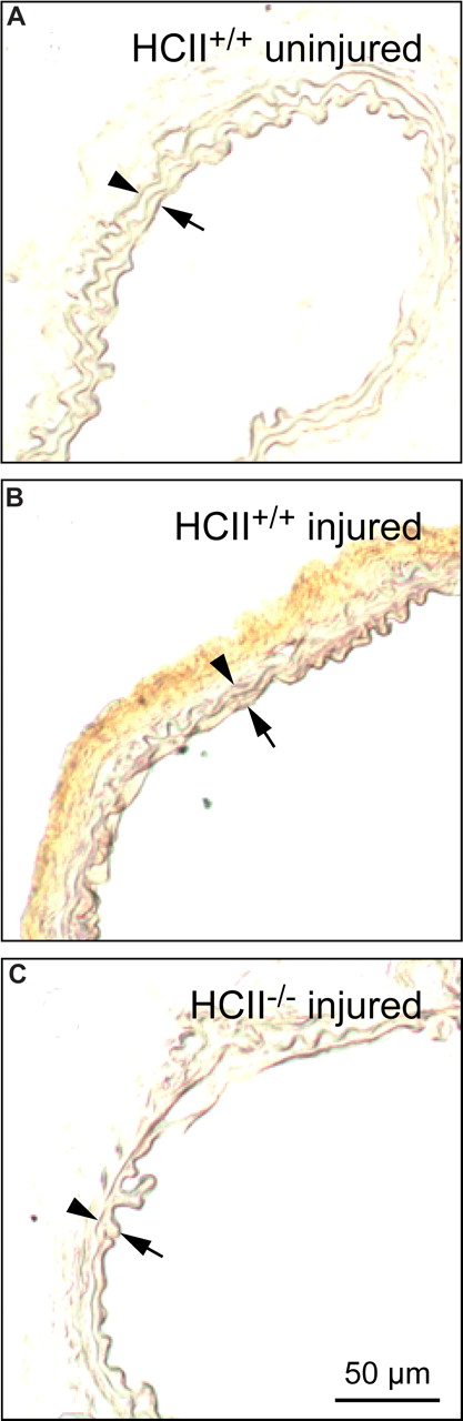 Figure 6. Distribution of endogenous HCII before and after injury. Frozen sections of carotid arteries harvested from HCII+/+ mice before (A) or 30 minutes after (B) the onset of injury were stained with a polyclonal goat anti–HCII IgG. No HCII antigen was detected in the injured carotid artery of a control (HCII−/−) mouse (C). Arrow indicates internal elastic lamina; arrowhead, external elastic lamina.