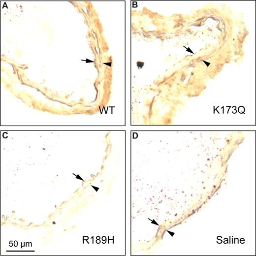 Figure 7. Distribution of rHCII variants after arterial injury. HCII−/− mice were injected with rHCIIWT (A), rHCIIK173Q (B), rHCIIR189H (C), or saline (D) and then subjected to photochemical injury as described in the legend to Figure 2. Frozen sections of arteries harvested 30 minutes after the onset of injury were stained with a polyclonal goat anti–HCII IgG. Arrow indicates internal elastic lamina; arrowhead, external elastic lamina.