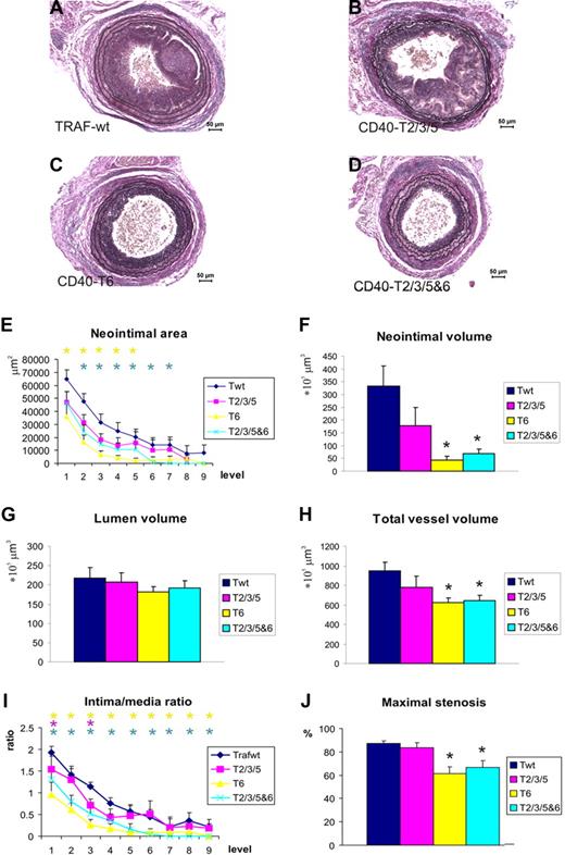 Figure 3. Neointima formation and carotid artery remodeling in CD40-Twt, CD40-T2/3/5, CD40-T6, and CD40-TRAF2/3/5&6 mice. Representative cross-sections are shown in panels A-D; n = 14, n = 10, n = 7, and n = 14, respectively. Neointima was measured at individual levels (200-μm intervals) throughout the ligated artery segments (E), and neointimal volume was calculated (F). Furthermore, volumes of lumen (G) and total vessel wall (H) were calculated, as well as intima/media ratios (I) and maximal stenosis rates (J). *P < .05 compared with CD40-Twt mice. Neointima formation in CD40-T6 mice was significantly reduced compared with CD40-Twt mice at levels 1-5, whereas reduction in neointima formation in CD40-T2/3/5&6 mice was significant at levels 2-7. Error bars represent SEM.
