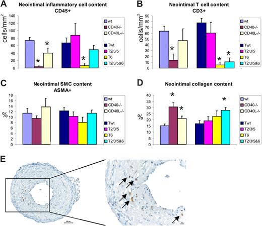 Figure 4. Neointimal lesion composition in CD40/CD40L deficiency or in mice with defective CD40-TRAF binding compared with controls. (A) Inflammatory cells stained with CD45-antibody, (B) CD3+ T-cell content of neointima, (C) amount of ASMA-positive SMCs, and (D) collagen content of neointimal lesions. *P < .05 compared with wild-type (for CD40−/− and CD40L−/− mice) or compared with CD40-Twt (for CD40-T2/3/5, CD40-T6, and CD40-T2/3/5&6 mice).