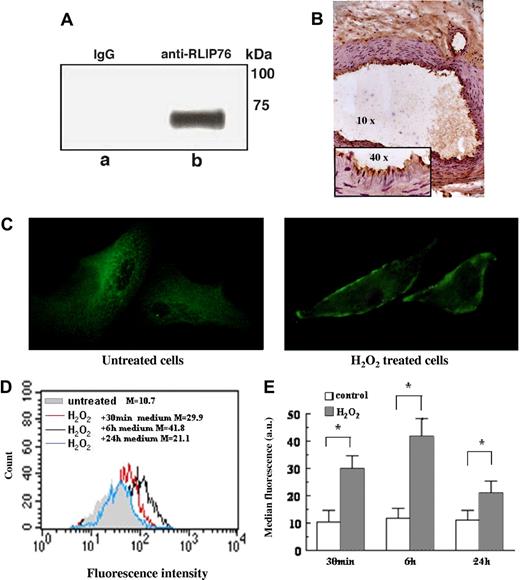 Figure 3. RLIP76 expression and localization.(A) EAhy926 were immunoprecipitated with mouse polyclonal anti-RLIP76 C-ter antibodies. The immunoprecipitates were analyzed by Western blotting, using anti–human RLIP76 C-ter antibodies. Bound antibodies were visualized with HRP-conjugated anti–human IgG and immunoreactivity was assessed by ECL. Virtually no reactivity was found with immunoprecipitates obtained using non RLIP76-specific IgG (irrelevant). (B) RLIP76 expression in vascular tissue was detected by immunohistochemistry on tissue arrays with histologic sections from normal vascular human tissue incubated with mouse anti-RLIP76 C-ter antibodies. Intense immunoreactivity was observed in vascular endothelium. (C) Immunofluorescence analysis of RLIP76 distribution in EAhy926 untreated cells (left panel) or treated with 30 μM H2O2 30 minutes (right panel). Original magnification 500×, objective 100×, numeric aperture 1.4. (D,E) Flow cytometric analysis after surface staining of EAhy926 cells with antibodies to the RLIP76 C-terminus. (D) Results obtained in a representative experiment. Full light-gray histogram: untreated control cells; red histogram: H2O2-treated cells incubated for 30 minutes with fresh medium; black histogram: H2O2-treated cells incubated for 6 hours with fresh medium; blue histogram: H2O2-treated cells incubated for 24 hours with fresh medium. (E) Time-course evaluation of RLIP76 expression in untreated cells and in cells treated with H2O2 and then incubated for 30 minutes, 6 hours, and 24 hours in fresh medium (mean ± SD of the results obtained from 3 different experiments). *P < .01 by Student t test.