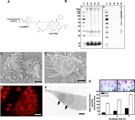 Figure 3. In vitro binding and erythrophagocytosis of RGD-modified erythrocytes by endothelial cells. (A) Structural formula of cyclic RGD-peptide coupled to erythrocyte transmembrane proteins via a sulfoEMCS heterobifunctional cross-linker. (B) SDS-PAGE gel (i) and anti-RGD antiserum-stained immunoblot (ii) of control untreated erythrocytes (lane 2), erythrocytes with sulfoEMCS linker (lane 3), erythrocytes with RGD (lane 4), and erythrocytes with sulfoEMCS linker and RGD (lane 5) lysates. The sizes of the bands of the PageRuler protein ladder (lane 1) are shown next to the SDS-PAGE gel. The corresponding immunoblot shows association of RGD-peptides with multiple transmembrane proteins only for the erythrocytes that contained both the sulfoEMCS linker and the RGD-peptides. (C) Scanning electron microscopy image of extensively bound RGD-erythrocytes to the endothelial cell membrane after 1-hour incubation. Scale bar represents 10 μm. (D) Retracted endothelial cell with bound RGD-erythrocytes, showing extensive blebbing as a sign of cytotoxicity that can already be observed after 30 minutes. Scale bar represents 5 μm. (E) Confocal microscopy image of autofluorescence of RGD-erythrocytes taken up by an endothelial cell after 4-hour incubation, demonstrating that cell binding is followed by erythrophagocytosis. Scale bar represents 10 μm. (F) Transmission electron microscopy (TEM) image of phagocytosed RGD-erythrocytes () in an endothelial cell after 1-hour incubation. Scale bar represents 2 μm. (G) Endothelial cell association of RAD- and RGD-modified erythrocytes. RGD-erythrocytes displayed enhanced binding at all time points compared with control RAD-erythrocytes (values ± SEM). Inserts show representative light microscopy images of erythrocyte-association at 4-hour incubation.