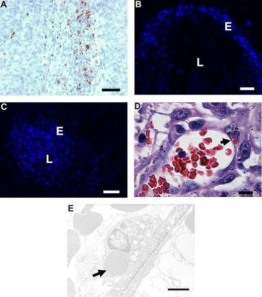 Figure 5. In vivo binding to tumor endothelium and erythrophagocytosis of intravenously administered RGD-erythrocytes in B16.F10 melanoma–bearing mice. (A) Immunohistologic detection of RGD-peptides in tumor tissue, 1 hour after intravenous administration, showing preferential accumulation in the tumor rim. Scale bar represents 200 μm. (B) Fluorescence microscopy image of a tumor blood vessel showing specific binding of RGD-erythrocytes to the vessel wall, 4 hours after intravenous administration of RGD-coupled DiD-labeled erythrocytes. Scale bar represents 30 μm. (C) Fluorescence microscopy image of a tumor blood vessel showing circulating plain DiD-labeled erythrocytes at 4 hours after intravenous administration. Scale bar represents 50 μm. (D) Light microscopy image of a tumor blood vessel showing internalization of multiple erythrocytes by endothelial cells (indicated by arrow) 2 hours after injection. Scale bar represents 10 μm. (E) Transmission electron microscopy image of an erythrocyte phagocytosed by a tumor endothelial cell (indicated by arrow) 4 hours after administration. Scale bar represents 2 μm.