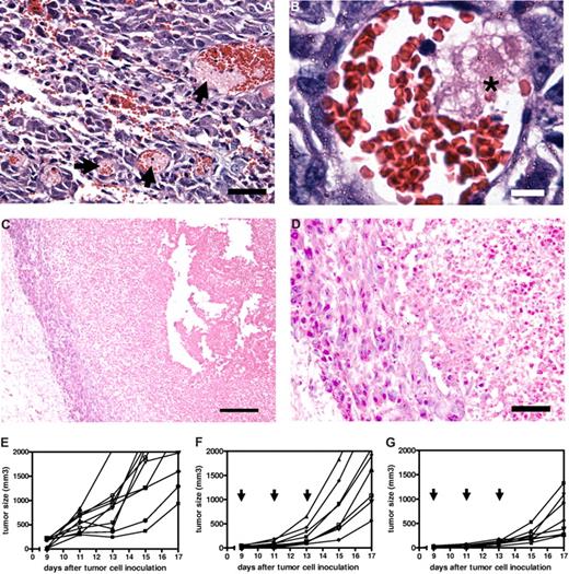 Figure 6. Therapeutic efficacy of tumor endothelium-targeted RGD-erythrocytes in a B16.F10 murine melanoma model. (A) Light microscopy image of tumor tissue showing thrombi formation in blood vessels (indicated by arrows), 4 hours after intravenous injection of RGD-modified erythrocytes. Tumors measured approximately 300 mm3. Scale bar represents 100 μm. (B) Light microscopy image of a tumor blood vessel showing local thrombus formation (indicated by asterisk) likely due to endothelial cell damage at 2 hours after intravenous injection. Scale bar represents 10 μm. (C) Light microscopy image showing a necrotic tumor core with a typical viable rim at 24 hours after intravenous injection of RGD-modified erythrocytes. Scale bar represents 200 μm. (D) Magnification of viable rim and necrotic tumor area showing a thin layer of cells forming the viable rim. Scale bar represents 50 μm. (E) Individual growth curves (n = 10) of untreated control mice. Mean tumor volume increase during the experiment: 1848 plus or minus 575 mm3 (mean ± SEM). (F) Individual growth curves (n = 8) after treatment with RAD-modified erythrocytes, arrows indicating day of treatment. Mean tumor volume increase during the experiment: 1787 plus or minus 312 mm3 (mean ± SEM). (G) Individual growth curves (n = 8) after treatment with RGD-modified erythrocytes, arrows indicating day of treatment. Mean tumor volume increase during the experiment: 636 plus or minus 149 mm3 (mean ± SEM); P = .005 compared with RAD-modified erythrocytes treated animals (Mann-Whitney test, 2 tailed).