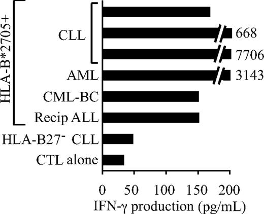 Figure 4. The DDX3Y-encoded H-Y antigen recognized by CTL 68H7-819 is expressed on the surface of HLA-B*2705+ leukemic cells. CTL 68H7-819 recognition of primary leukemic samples from males carrying the HLA-B*2705 allele was tested by IFN-γ ELISA after overnight coculture with CTL at a CTL/leukemia ratio of 1:5. The 6 samples consisted of BMMCs derived from the hematopoietic cell transplant recipient from whom CTL 68H7-819 was derived (Recip ALL), PBMCs from one patient each with primary refractory AML and with CML in T-lymphoid blast crisis (CML-BC), and 3 PBMC samples from CLL patients. Negative controls included a CLL sample that did not carry the HLA-B*2705 allele, and CTL 68H7-819 alone.