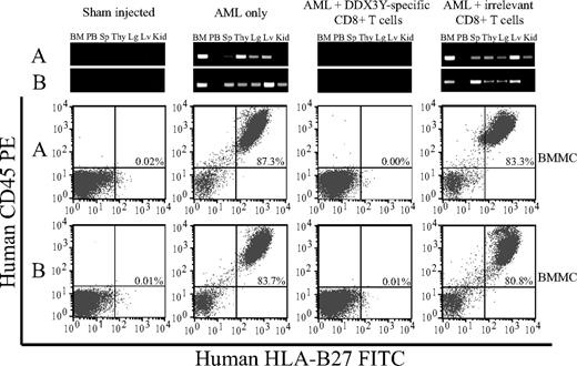 Figure 6. CTL 68H7-819 targets the leukemic stem cell in AML. Flow cytometric analysis using human PE-conjugated antihuman CD45 and FITC-conjugated anti–HLA-B27 antibodies of BMMCs from representative mice injected with PBS (sham), or with AML cells that had either been cultured overnight in medium alone, with CTL 68H7-819, or with an irrelevant CD8+ CTL clone that did not recognize the AML in vitro. Top panels show human Y-chromosome–specific PCR analysis of genomic DNA isolated from BMMCs (BM), peripheral blood (PB), spleen (Sp), thymus (Thy), lung (Lg), liver (Lv), and kidney (Kid). The flow cytometry and PCR data from 2 representative mice from each group are shown, and are designated as A or B.