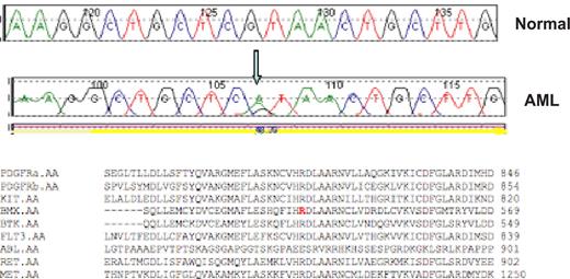 Figure 1. Representative sequence trace. A representative reference (normal) and AML sequence trace comparison are shown for the BMX R540H mutation. The arrow notes the guanine to adenine substitution that results in an arginine to histidine substitution at codon 540. Protein alignment demonstrates this residue is highly conserved within the tyrosine kinase family.