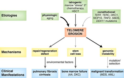 Figure 4. Proposed model for the role of dysfunctional and short telomeres in the pathogenesis of human disease. Aging, bone marrow stress, and genetic factors, such as mutations in telomerase complex genes (TERT, TERC, DKC1, and NOP10), shelterin components (TINF2, TERF1, and TERF2), or in other genes (SBDS and DDX11) produce progressive telomere erosion. Excessive telomere shortening results in defective cell proliferation, senescence, apoptosis, and genomic instability. Environmental factors, such as viruses, drugs, smoking, or asbestos exposure, may contribute to telomere shortening as well as injury to an organ with limited regeneration capacity, thus triggering disease development (aplastic anemia, pulmonary fibrosis, and hepatic cirrhosis). Short telomeres also promote genomic instability, breakage-fusion-bridge cycles, and aneuploidy, which can lead to myelodysplasia (MDS) or leukemia (AML).