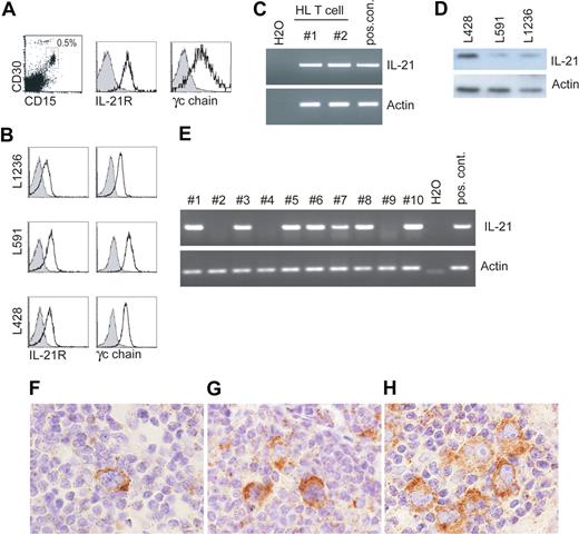 Figure 1. IL-21R, CD132, and IL-21 expression on HL cells. Flow cytometric analysis for IL-21R and γc chain (CD132) expression on (A) primary HL tissue and (B) HL cell lines, L1236, L591, and L428. For IL-21R expression on primary HL cells we gated on the CD30+CD15+ cells and γc chain expression is gated on CD15+ cells. Gray histogram is isotype control. Representative of 5 different donors. (C) RT-PCR for IL-21 and actin expression on HL-infiltrating sorted T cells (n = 2). (D) Immunoblot analysis for IL-21 and actin as a loading control was performed on 3 HL cell lines (n = 3). (E) RT-PCR for IL-21 and actin on cDNA generated from laser capture-isolated purified HL cells from 10 different donors (nos. 1-10). (F-H) Multinucleated HL cells stained positive for IL-21 protein by immunohistochemistry (brown staining). Stainings from 3 different representative patient tumor samples (of 6 patients tested) are shown. Immunohistochemistry for IL-21 was performed on paraffin-embedded tumor sections from HL patients using a rabbit polyclonal anti–IL-21 Ab (0.5 μg/ml; eBioscience). Functionality of the anti–IL-21 Ab was established on paraffin-embedded tonsil tissue as described.33 IL-21 staining was developed using the CSA-II kit (Dako Cytomation) with DAB detection; tissue was counterstained with hematoxylin. Slides were visualized on an Olympus BX51 light microscope (Olympus, Zoeterwoude, The Netherlands) using a UPlan/Apo 40×/0.85 objective and Olympus DP70 camera. Images were captured with Olympus DP Controller software version 1.2.1.108 and were processed with Adobe Photoshop 7.0. (Adobe Systems, San Jose, CA).
