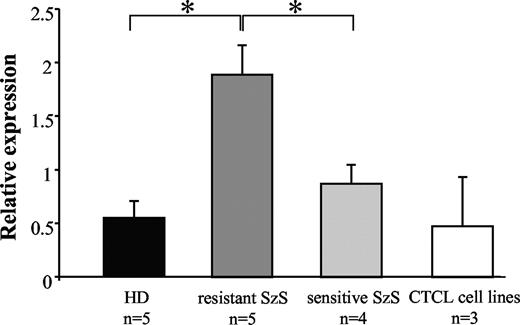 Figure 2. cFLIP is overexpressed in SzS CD4+/CD26− cells. cDNA from HD (n = 5), Fas-expressing FasL-resistant SzS (n = 5, patients 3, 4, 5, 7, and 9), Fas-expressing FasL-sensitive (n = 4, patients 11, 14, 15, and 16) CD4+/CD26− sorted cells and HUT78, MyLa, and SeAx cell lines were amplified using cFLIP specific primers and compared with HsEEF1A1, GusB, and ALAS expression. Mean (± SD) of the relative expression is reported.