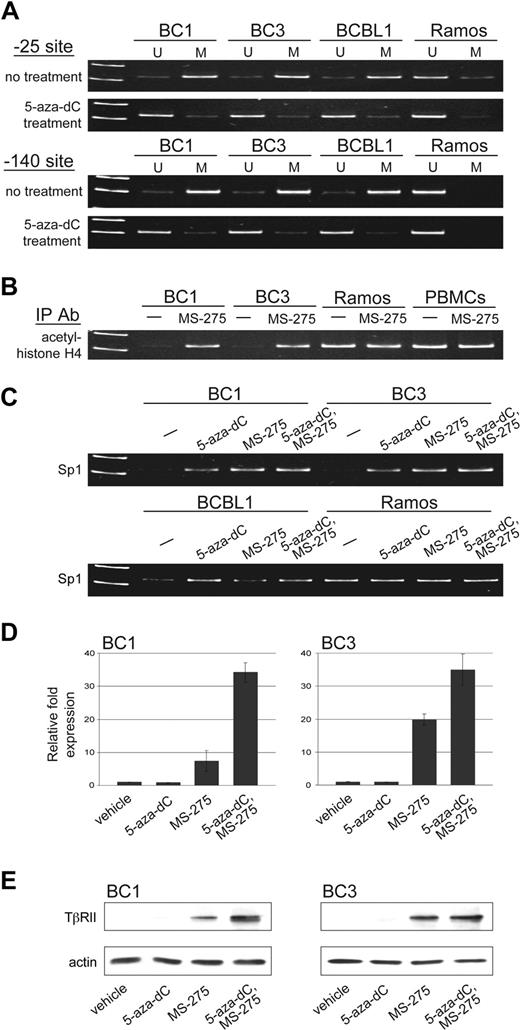 Figure 3. TβRII gene expression is subject to epigenetic silencing in PEL cells. (A) Methylation status at positions −25 and −140 of the TβRII promoter in PEL cell lines, BC1, BC3, and BCBL1, and Burkitt lymphoma cell line, Ramos, before and after 5-aza-dC treatment determined by methylation-specific PCR (U indicates unmethylated; M, methylated). (B) ChIP analysis for acetylated histone H4 and (C) Sp1 under the indicated conditions for 48 hours. (D) TβRII expression analyzed by real-time PCR and (E) Western blot after indicated treatments. Error bars represent SD.