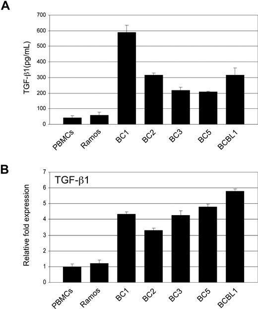 Figure 4. PEL cells secrete elevated levels of TGF-β1. (A) TGF-β1 levels in supernatants taken from PEL cell lines, Ramos, and PBMCs determined by ELISA. (B) Real-time PCR analysis of TGF-β1 in PEL and Ramos cell lines and PBMCs. Error bars represent SD.