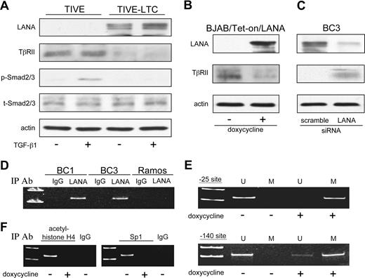 Figure 6. LANA inhibits TβRII expression through epigenetic silencing. (A) Western blot for TβRII and phosphorylated Smad2/3 in KSHV+ LTCs and their uninfected TIVE cell counterparts in response to TGF-β1 treatment. (B) Expression of TβRII on induction of LANA in BJAB/Tet-on/LANA cells and (C) on siRNA knockdown of LANA in BC3 cells. (D) ChIP analysis of LANA association with the TβRII promoter. (E) Methylation status at positions −25 and −140 of the TβRII promoter in BJAB/Tet-on/LANA cells determined by methylation-specific PCR (U indicates unmethylated; M, methylated). (F) ChIP analysis of acetylated histone H4 and Sp1 at the TβRII promoter in BJAB/Tet-on/LANA cells.