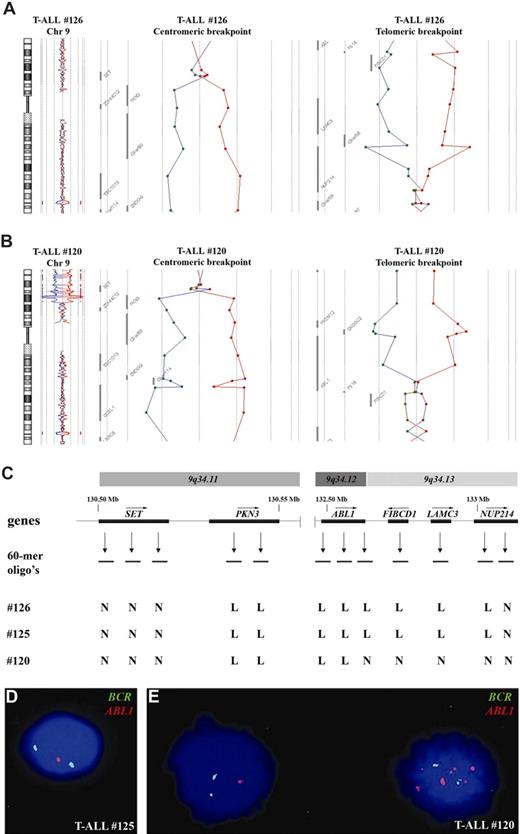 Figure 2. Submicroscopic del(9)(q34.11q34.13) in T-ALL. (A) Chromosome 9 ideogram and corresponding oligo array-CGH plots of test DNA–control DNA ratios (blue tracing) versus the dye-swap experiment (red tracing) for patient no. 126. Detailed analyses of the centromeric and telomeric breakpoints show involvement of SET and NUP214. (B) Similar array-CGH plot for patient no. 120. Centromeric and telomeric breakpoints show involvement of SET and ABL1. (C) Overview of oligoarray-CGH results in the potential breakpoint regions for 3 patients with T-ALL with del(9)(q34.11q34.13). The 60-mer oligonucleotide probes present on the array-CGH slide and located in the telomeric and centromeric breakpoint regions, as well as the specific genes located in this region with their transcription direction, are shown. Abbreviations: N; normal, L; loss. Dual-color FISH analysis of patient no. 125 (D) and no. 120 (E) using the LSI BCR-ABL ES translocation probe.