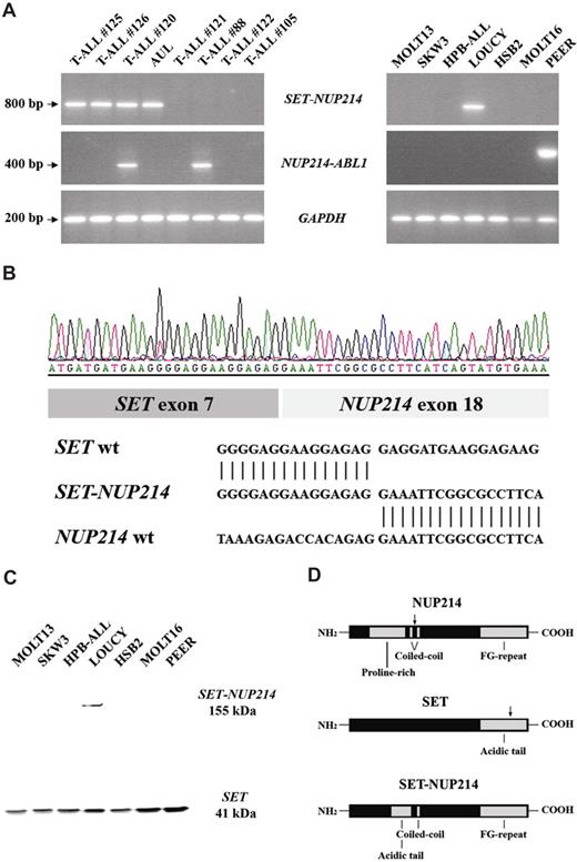 Figure 3. SET-NUP214 fusion transcript in T-ALL. (A) RT-PCR analysis using SET- and NUP214-specific primers and GAPDH primers as internal control, reveals a specific SET-NUP214 fusion gene in T-ALL patient nos. 125, 126, and 120; the patient with AUL; and the T-ALL cell line LOUCY. NUP214-ABL1 fusion was detected in patient nos. 120 and no.88 and in the T-ALL cell line PEER (B) Sequence analysis confirmed an identical fusion between exon 7 of SET and exon 18 of NUP214 in all SET-NUP214+ patients with T-ALL, the patient with AUL, and the LOUCY cell line. (C) Western blot analysis of T-ALL cell lines revealed a SET-NUP214 fusion in the cell line LOUCY. (D) At the protein level, the breakpoints are situated in the acidic tail of SET and the coiled-coil domain of NUP214.