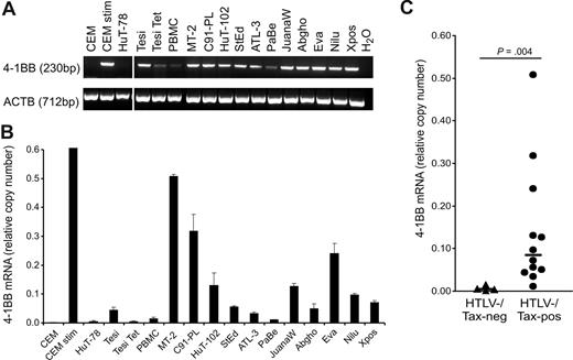 Figure 1. Up-regulation of 4-1BB mRNA in HTLV-1/Tax–positive cells. (A) Transcripts of 4-1BB and β-actin (ACTB) were detected by RT-PCR. Vertical lines have been inserted to indicate a repositioned gel lane. (B) Transcripts of 4-1BB were quantified by real-time RT-PCR. Relative copy number was determined by normalizing the 4-1BB transcripts to those of β-actin. The means of 3 independent experiments plus or minus standard error are shown. (C) Relative copy numbers of 4-1BB mRNA in HTLV-1/Tax–positive cell lines (Tesi, MT-2, C91-PL, HuT-102, StEd, ATL-3, PaBe, JuanaW, Abgho, Eva, Nilu, Xpos) were compared with those of HTLV-1/Tax–negative controls (CCRF-CEM, HuT-78, Tesi + tet, PBMCs) using a 2-tailed Mann-Whitney test. Horizontal bars indicate the median; •, HTLV-1/Tax–positive cell lines; and ▴, the HTLV-1/Tax–negative controls.