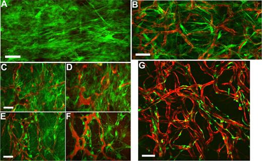 Figure 5. Intravital monitoring of EGFP-hMSCs in a tissue-engineered vessel model. Fibronectin-collagen constructs with EGFP-hMSCs alone (A) or EGFP-hMSCs with DsRed-HUVECs (B-G) were implanted into cranial windows of SCID mice. Images were taken at different time points with multiphoton laser scanning microscopy (MPLSM) (B, day 7; C,D, day 19; E,F, day 31; G, day 83). Green indicates human mesenchymal stem cells expressing EGFP (A-G); red, HUVECs expressing DsRed-express fluorescent protein (B-E,G); and red, functional blood vessels contrast-enhanced by rhodamine-dextran (D,F). Scale bars represent (A,B,G) 100 μm; (C-F) 50 μm.