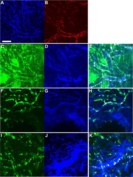 Figure 6. Expression of smooth muscle cell markers in hMSC-derived cells incorporated into the tissue-engineered vessels. Whole-mount staining was performed for the extracted tissue-engineered vessel constructs. (A-H) Confocal microscopy images. (A) Blue indicates DAPI staining; (B) red, DsRed-HUVECs; (C,F,I) green, EGFP-hMSCs; (D) blue, α-smooth muscle actin staining; (G) blue, SM22α staining; and (J) blue, desmin staining. Region of colocalized staining of EGFP and smooth muscle markers is highlighted as white (E,H,K). Panels A-E, F-H, and I,J are the same location/construct. Scale bar represents 100 μm.