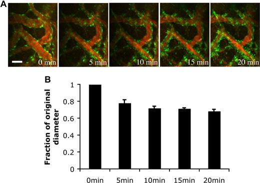 Figure 7. Endothelin-1 stimulated vasoconstriction of the engineered blood vessels. HUVEC/hMSC-derived engineered blood vessels were superfused with 100 nM endothelin-1 to stimulate vasoconstriction in vivo. (A) Representative multiphoton microscopy images during endothelin-1 superfusion. Green indicates EGFP-hMSCs; red, functional blood vessels contrast-enhanced by rhodamine-dextran. Scale bar represents 50 μm. (B) The blood vessel diameter was quantified over a 20-minute period (n = 4). The value was expressed as a fraction of the original diameter. Scale bar represents 50 μm.