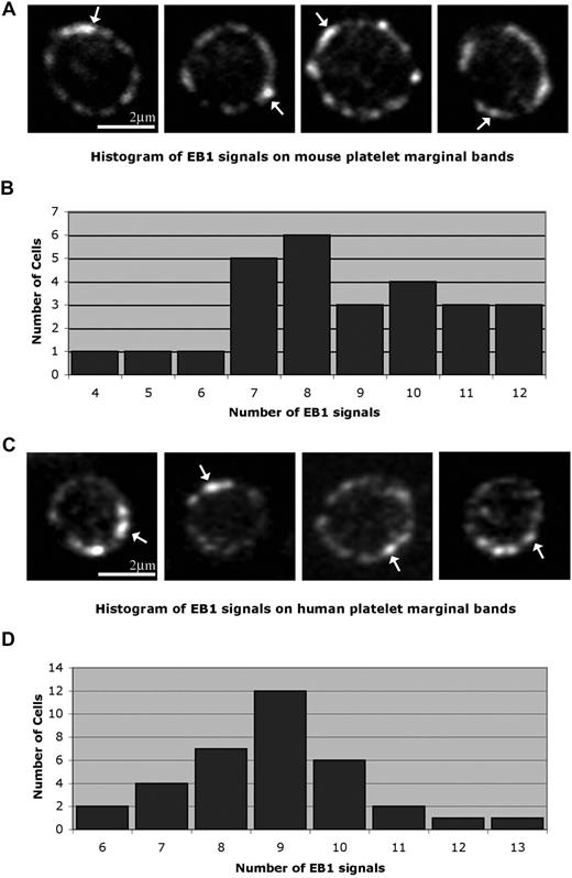 Figure 1. Localization of microtubule plus ends in the platelet marginal band. (A) Methanol-fixed resting mouse platelets labeled with anti-EB1 antibodies. EB1 “comets” () are labeled along the marginal band. An average of 8.66 (± 2.11; n = 26) comets were observed along the marginal band. (B) Histogram showing EB1 signals observed along the microtubule coil of each mouse platelet. The number of signals ranged from 4 to 12, with a median of 8. (C) Anti-EB1 staining in resting human platelets. EB1 comets () are identified. An average of 8.9 (± 1.5; n = 34) comets are seen along each coil. (D) Histogram of EB1 signals along the microtubule coil of human platelets. The number of signals ranged from 6 to 13, with a median of 9.