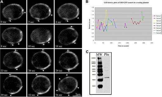 Figure 3. Multiple microtubules polymerize along the marginal band in living platelets. (A) Fluorescence microscopy of platelets released from cultured mouse megakaryocytes directed to express EB3-GFP showing the movements of multiple EB3-GFP comets, an indicator of polymerizing microtubules, along the periphery of the platelet. The time course follows a platelet with EB3-GFP comets moving both clockwise () and counterclockwise () over the course of 32 seconds. The final panel (76 seconds) shows the same cell with several EB3-GFP comets and foci (). (B) Life history plots of 8 individual EB3-GFP comets within a resting platelet show distance traveled over time. (C) Western blot detection of endogenously expressed EB3 in platelet lysates.
