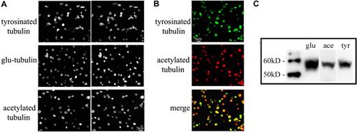 Figure 4. The microtubule coil contains both stable and dynamic microtubules. (A) Immunofluorescence analysis of mouse platelets using antibodies to Tyr-tubulin, Glu-tubulin, and acetylated tubulin indicates that all 3 modified tubulin forms exist in the marginal band. Cells were double-labeled with an antibody to β1-tubulin. (B) Immunofluorescence analysis of mouse platelets using antibodies to Tyr-tubulin (top panel) and acetylated tubulin (middle panel). Note that both isoforms accumulated within platelet marginal bands, although some platelets appear to label more strongly with one antibody than with the other (bottom panel). (C) Western blot of mouse platelet lysates; equal protein quantities were loaded and probed with antibodies to Glu-tubulin (glu), acetylated tubulin (ace), and Tyr-tubulin (tyr).