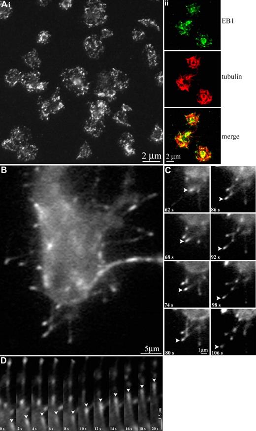Figure 6. Visualization of microtubule polymerization in living platelets during activation. (Ai) Thrombin-activated human platelets fixed and stained with anti-EB1 antibodies. An average of 25.5 (± 8.6) sites of EB1 localization are seen. (Aii) Thrombin-activated human platelets fixed and double-labeled with anti-EB1 (green) and antidetyrosinated tubulin (red) antibodies. (B) A platelet released from a megakaryocyte infected with EB3-GFP. Note the microtubule growth (indicated by the fluorescent comets) that occurred during activation. (C) In vivo labeling of extended filopodia with multiple EB3-GFP comets. Note (arrowheads) the movement of a single EB3-GFP comet, which appears to move away from the cell body. (D) Kymograph of EB3-GFP comet movements; platelet cell body faces up in this figure. Arrowheads track the movements of a single EB3-GFP comet in consecutive frames.