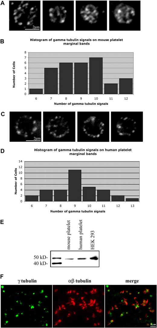 Figure 7. Localization of γ-tubulin in resting and activated platelets. (A) Purified mouse platelets labeled with anti–γ-tubulin antibody show the localization of microtubule minus ends along the microtubule coil. γ-Tubulin foci averaged 9.06 (± 1.61) signals along the microtubule coil of each platelet (N = 31). (B) Histogram of γ-tubulin signals along the marginal band of mouse platelets. The number of signals ranged from 6 to 12, with a median of 9. (C) Anti–γ-tubulin–stained human platelets show localization at multiple points along the microtubule coil. An average of 9.2 (± 1.7; n = 33) γ-tubulin signals are seen along the coil. (D) Histogram of γ-tubulin signals on the marginal band of human platelets. The number of signals per platelets ranged from 6 to 13, with a median of 9. (E) Western blot detection of γ-tubulin in mouse and human platelet lysates, and HEK 293 cell lysate. Samples of equal protein concentrations were examined. The single protein band detected in each lane shows a relative mobility of approximately 48 kDa, corresponding to the molecular weight of γ-tubulin. (F) Purified human platelets activated with thrombin were formaldehyde-fixed and incubated in anti–γ-tubulin antibody (green) and anti–αβ-tubulin antibody (red). Note the γ-tubulin labeling within the central portion of the activated platelets, while the αβ-tubulin extends outward within filopodia.