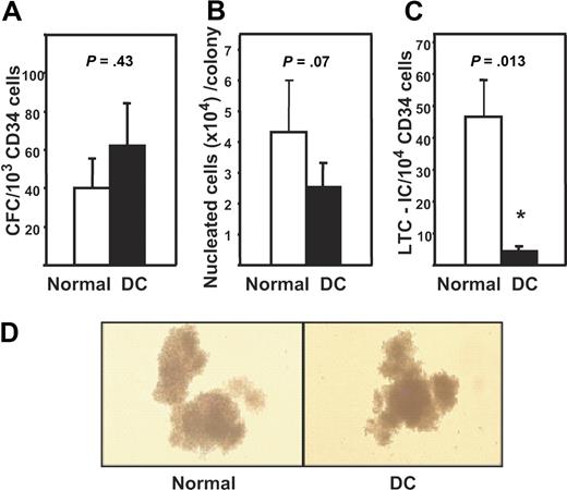 Figure 1. CFC and LTC-IC activity of DC mPB cells. (A) Mean plus or minus SEM frequency of CFCs expressed per 103 CD34+ cells in the 5 DC mPB samples (black bar) and in 5 healthy donors (□). Values shown are the sum of the total erythroid (BFU-E), granulopoietic (CFU-GM), and multilineage (CFU-GEMM) progenitors detected in these assays. (B) Measurements of the average size (nucleated cell content) of the colonies produced in panel A. Values shown are the mean plus or minus SEM. Each value was calculated by dividing the total number of cells measured in the 2-week CFC assay cultures (as described in “Methods”) by the total number of colonies scored in those assay cultures. (C) Mean plus or minus SEM of the number of LTC-ICs expressed per 104 DC (■) and normal (□) CD34+ mPB cells assayed. (D) Photomicrographs of typical colonies detected in the CFC assays of normal (left panel) and DC (right panel) cells.