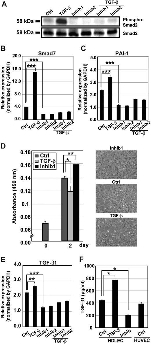 Figure 1. Transduction of TGF-β signals in HDLECs. (A) Immunoblotting of phospho-Smad2 after TGF-β or TβR-I inhibitor treatment. HDLECs were treated with TGF-β1 or with 2 kinds of TβR-I inhibitors (LY364947 or SB431542, shown as Inhib1 or Inhib2, respectively) in the presence and absence of TGF-β1 for 1 hour, and subjected to immunoblot analysis using phospho-Smad2 antibody (top panel) and Smad2/3 antibody (bottom panel). Ctrl indicates control. (B,C) Real-time PCR of Smad7 and PAI-1. HDLECs were treated as in panel A, and expression of Smad7 and PAI-1 mRNAs was determined at 1 hour and 24 hours after stimulation, respectively (***P < .001). (D) Regulation of growth of HDLECs by TGF-β and TβR-I inhibitor. HDLECs were seeded at a density of 2 × 103 cells/well in 96-well plates, and cells were treated or not with TGF-β1 (1 ng/mL) or LY364947 (3 μM). Photographs of the cells were taken at day 2. Cell numbers were determined by WST assay in triplicate at day 2. Error bars represent standard deviations (*P < .05, **P < .01). (E,F) Autocrine TGF-β signaling in HDLECs. Expression of TGF-β1 mRNA in HDLECs treated with TGF-β1 (1 ng/mL) or TβR-I inhibitors (3 μM) as in panel A was determined by real-time PCR (E). Production of TGF-β1 protein by HDLECs treated as in panel A, but with TGF-β3 (1 ng/mL) as the stimulant, was examined in conditioned medium using an ELISA kit (F). LY364947 was used as TβR-I inhibitor (Inhib). HUVECs were used as a control. Error bars represent standard deviations (*P < .05, **P < .01, ***P < .001).